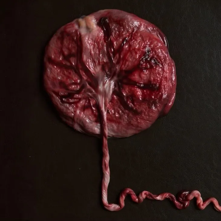A bloody red and pink placenta is laying on a black background